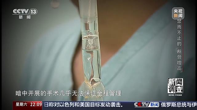 术后麻烦不断,禁而不止的“断骨增高” 有多坑?