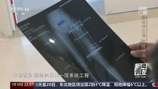 术后麻烦不断,禁而不止的“断骨增高” 有多坑?