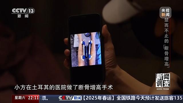 术后麻烦不断,禁而不止的“断骨增高” 有多坑?