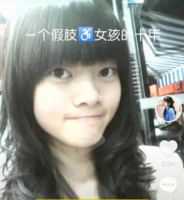 湖南29岁美女晒马甲线引全网爆赞,4岁时失去右腿