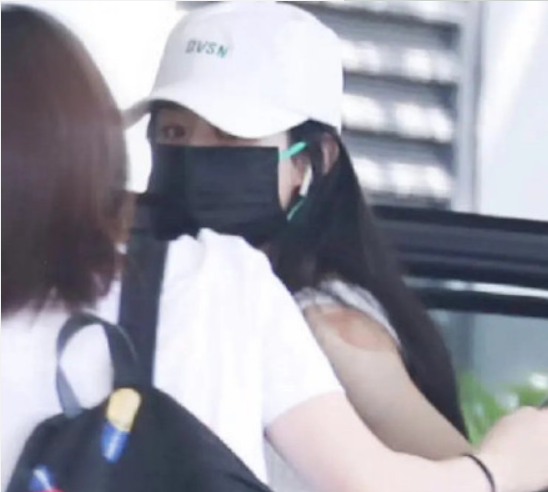 赵丽颖也会拔火罐啊,笑死了,印都露出来了,网友直呼可爱