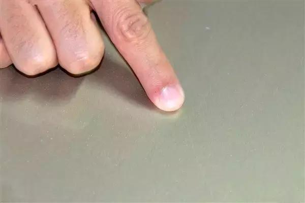 这些小刮痕不处理好，随时会腐蚀车身！