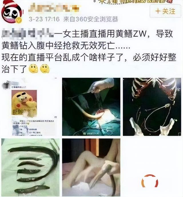 “黄鳝门”事件曝光,警方严查淫秽直播平台