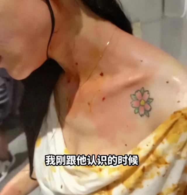 美女被丈夫家暴16次,肠子被打烂粪便污染腹腔,需终身挂粪袋