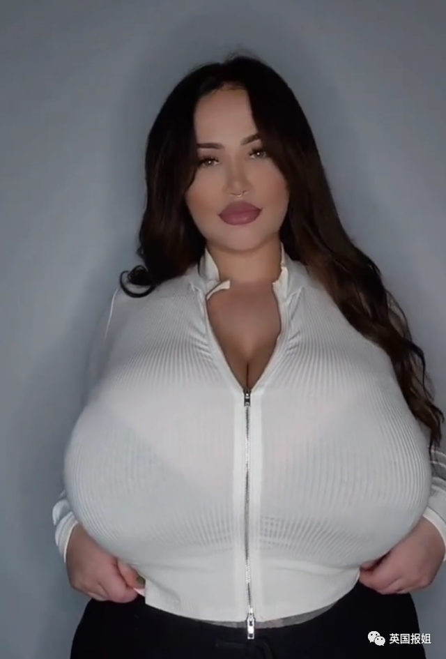 澳洲网红患上“巨乳症”,一年胸围暴涨6个罩杯!被压到喘不过气