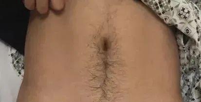 离奇!花季少女长出男性器官…