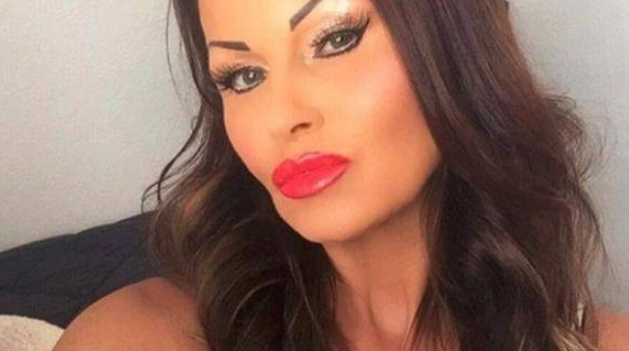 美国63岁大妈,为得到23男友的欢心,花费50万整容成少女