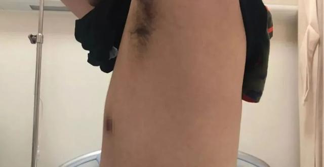 离奇!花季少女长出男性器官…