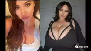 k罩杯美女(澳洲网红患上“巨乳症”，一年胸围暴涨6个罩杯被压到喘不过气)