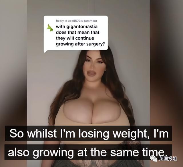 澳洲网红患上“巨乳症”,一年胸围暴涨6个罩杯!被压到喘不过气