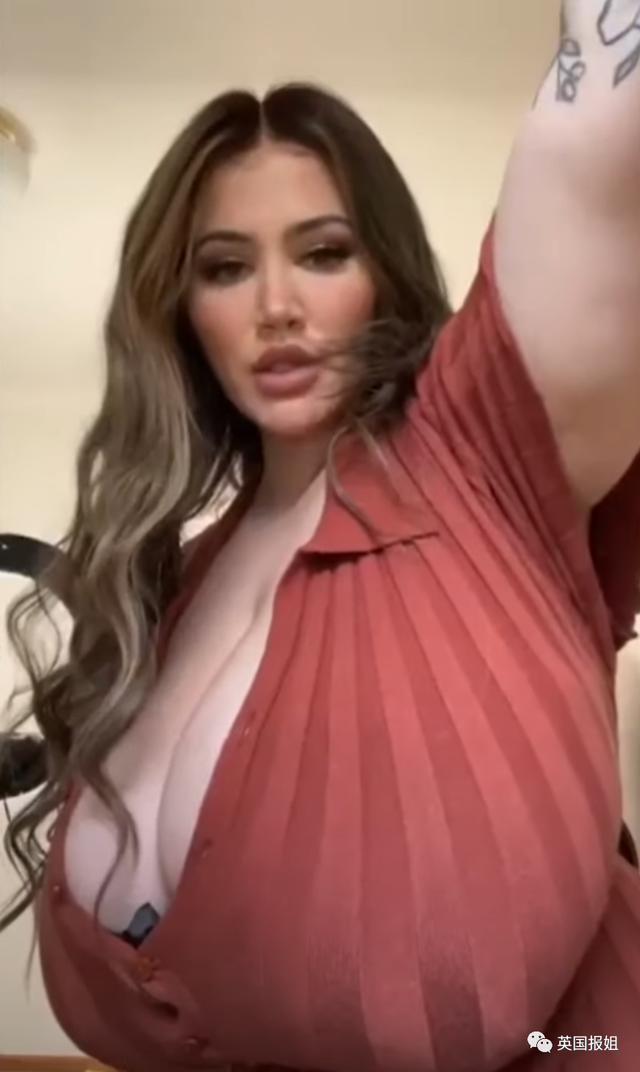 澳洲网红患上“巨乳症”,一年胸围暴涨6个罩杯!被压到喘不过气