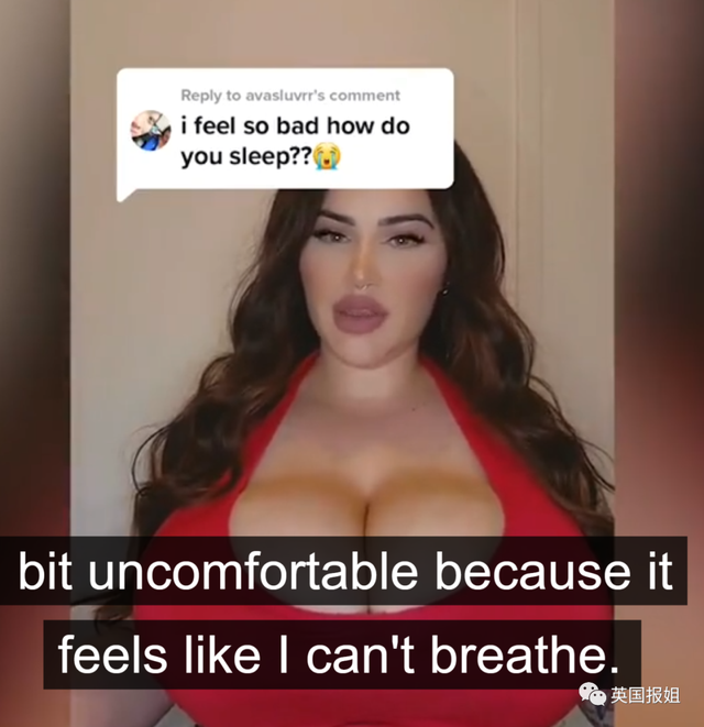 澳洲网红患上“巨乳症”,一年胸围暴涨6个罩杯!被压到喘不过气