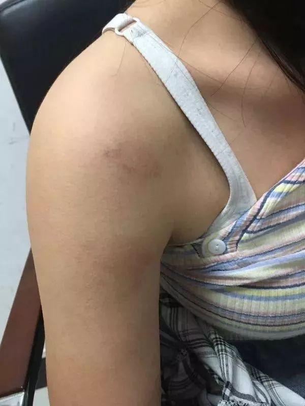 17岁女孩被室友扒衣围殴50分钟,打人者:我家有钱打死你怎么样?