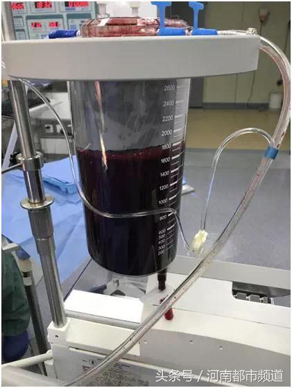 杭州16岁少女不明情况腹痛 拉肚子“拉”掉一半血,差点送命!