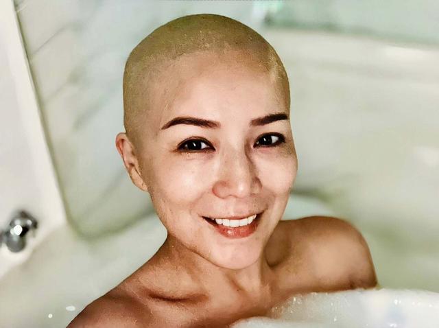 乳腺癌复发!香港知名女星完成细胞免疫治疗,勇敢以光头形象出镜