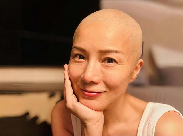 乳腺癌复发!香港知名女星完成细胞免疫治疗,勇敢以光头形象出镜