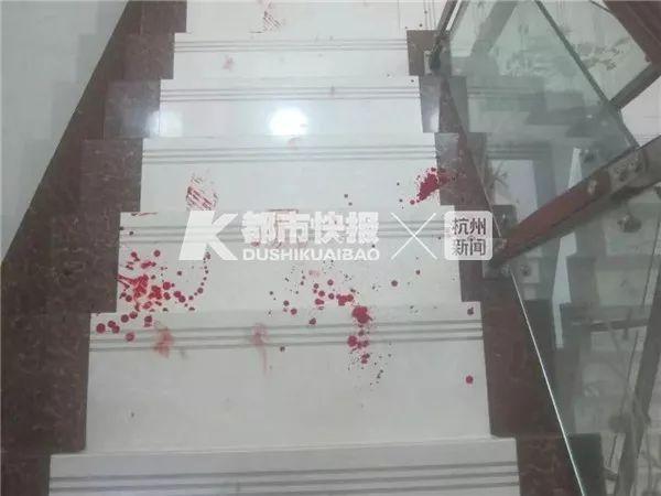 深夜，男子闯进一对夫妻卧室，朝自己手腕割了一刀！他说：一切都是因为爱情……