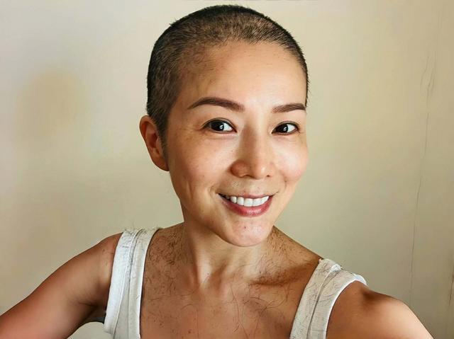 乳腺癌复发!香港知名女星完成细胞免疫治疗,勇敢以光头形象出镜