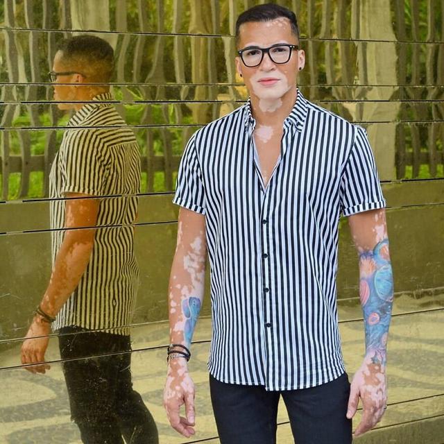 他大胆露出全身的白癜风，拍出的照片让34万人点赞