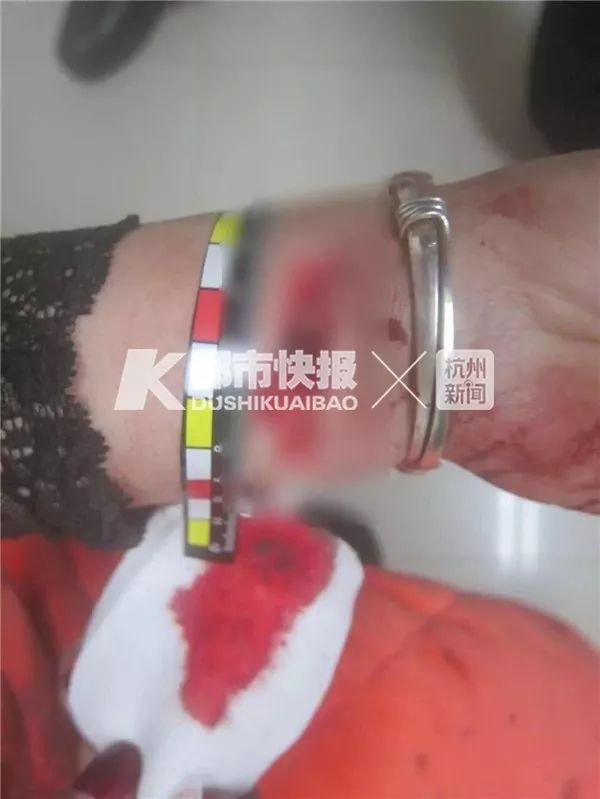 深夜，男子闯进一对夫妻卧室，朝自己手腕割了一刀！他说：一切都是因为爱情……