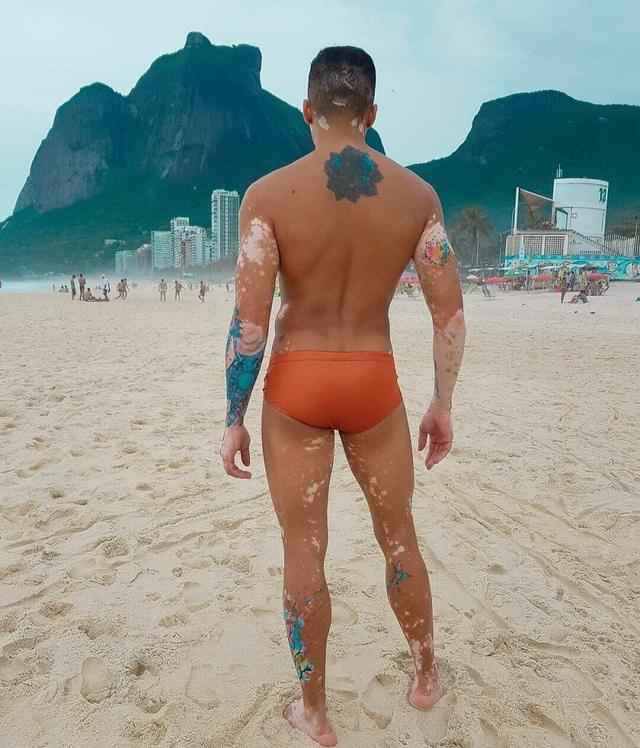 他大胆露出全身的白癜风，拍出的照片让34万人点赞