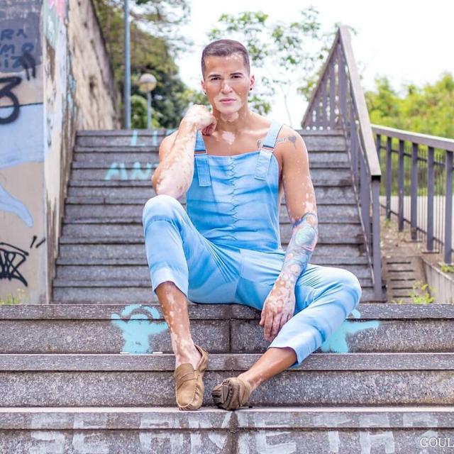 他大胆露出全身的白癜风，拍出的照片让34万人点赞