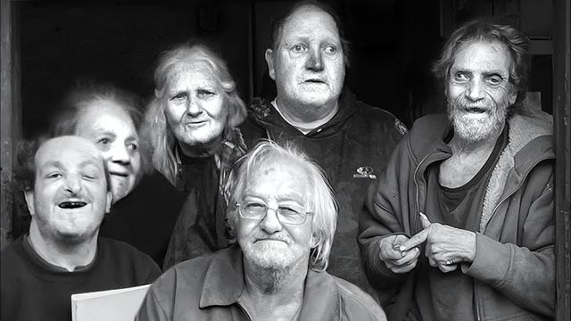 美国家族乱伦三代：近亲结合导致后代残障，无法说话只能犬吠