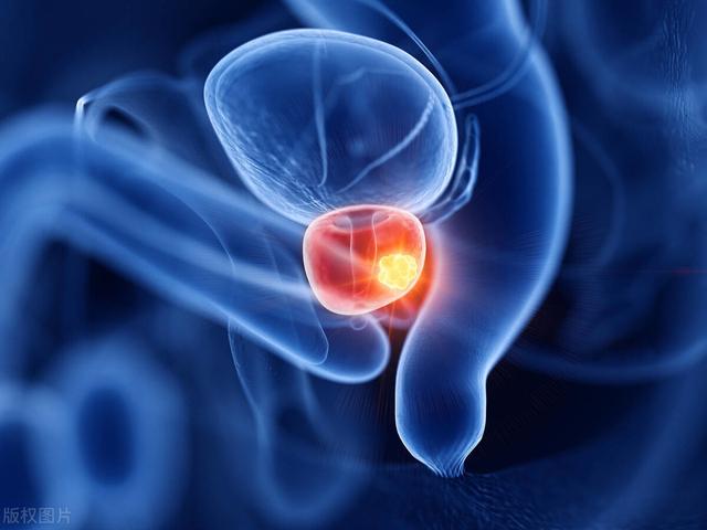 长这么大，你的“丁丁”有洗干净过吗？男人不妨来学习下