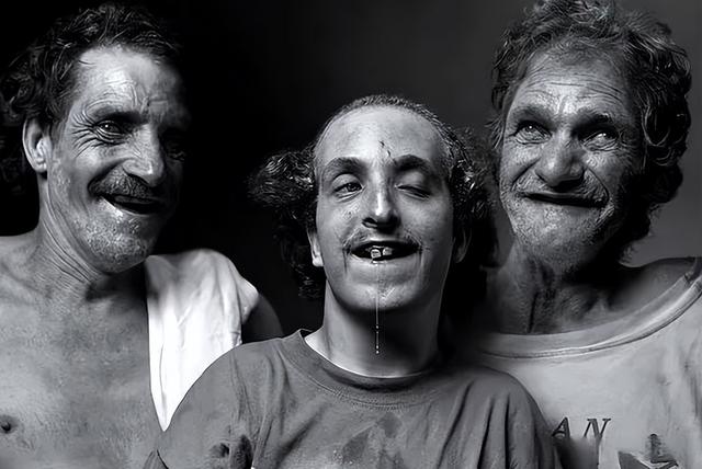 美国家族乱伦三代：近亲结合导致后代残障，无法说话只能犬吠