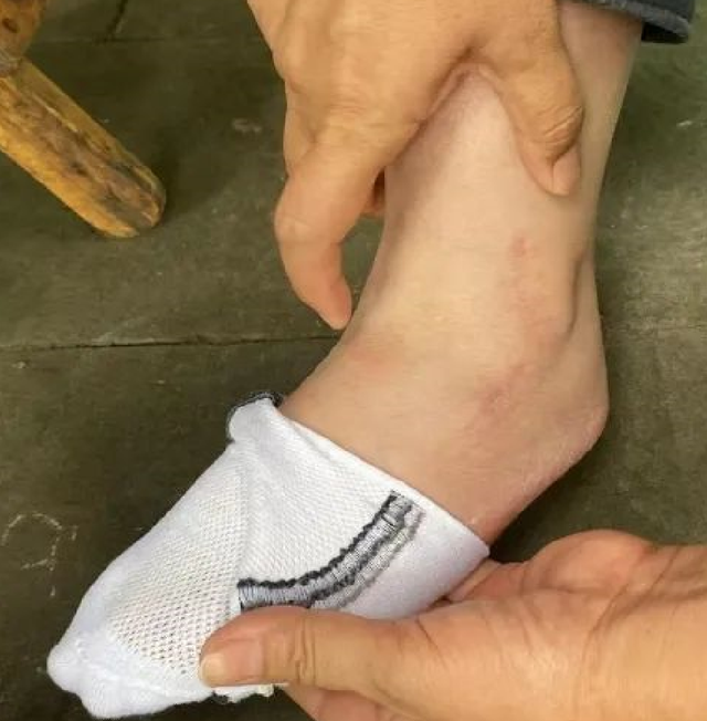 四川一“楼长”学姐查零食,13岁女生被罚150个下蹲,致终身残疾