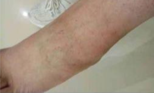 四川一“楼长”学姐查零食,13岁女生被罚150个下蹲,致终身残疾