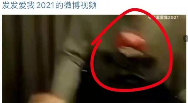 两点锤实华晨宇整容植发!大V呼吁这属于泄露隐私,网友怒其不争