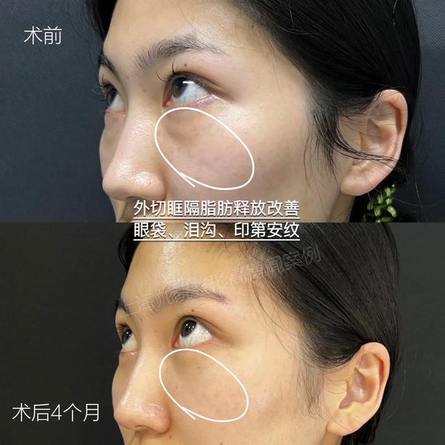 讲讲印第安纹的那些事儿