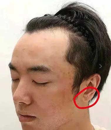 两点锤实华晨宇整容植发!大V呼吁这属于泄露隐私,网友怒其不争