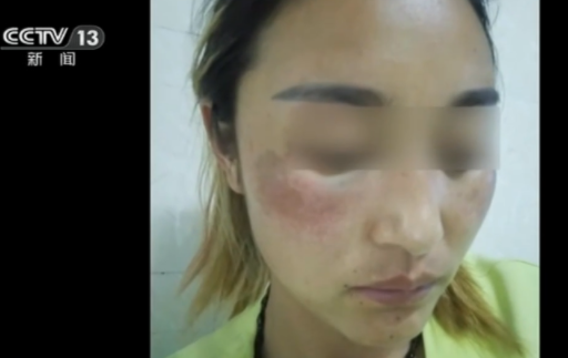 两次因家暴离婚，直播中被前夫泼汽油烧死，百万网红拉姆案始末