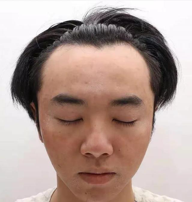 两点锤实华晨宇整容植发!大V呼吁这属于泄露隐私,网友怒其不争