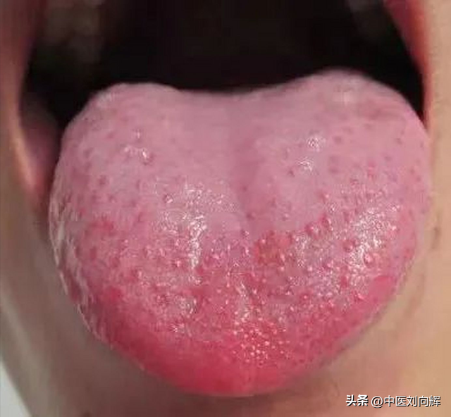 欲望大？有想法？就是肾好吗？中医：那是虚！中医教你补肾清火