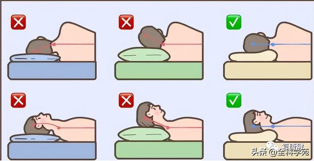 枕大神经体表定位 & 枕大神经痛的预防