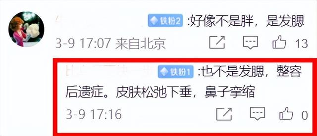 33岁韩星李钟硕最新生图曝光！脸肿发腮油光满面，鼻子彻底崩了