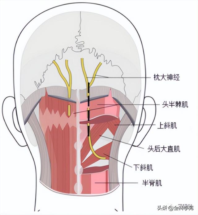枕大神经体表定位 & 枕大神经痛的预防
