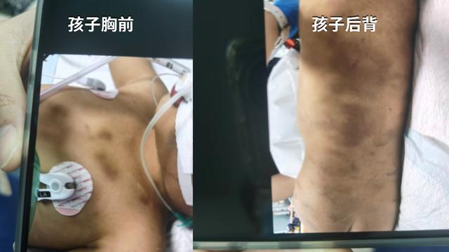 3岁男童被生父女友虐待致死，生母：警方说监控过于暴力，仅口头转述