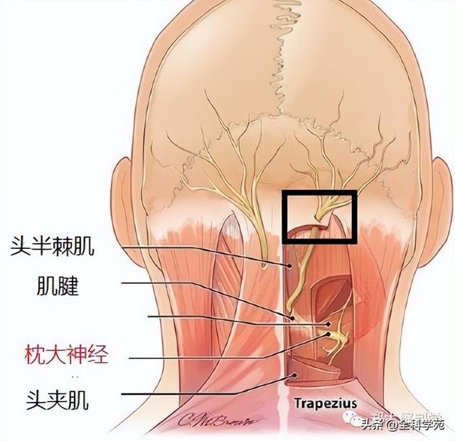 枕大神经体表定位 & 枕大神经痛的预防