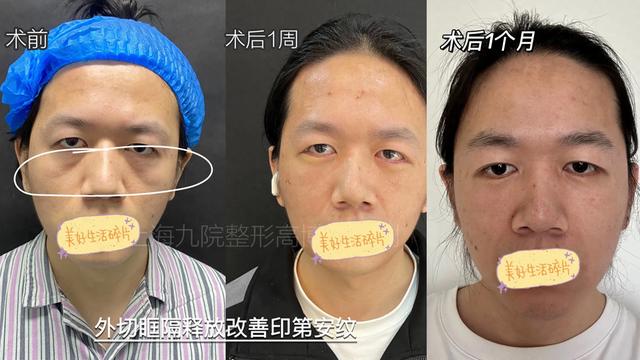 讲讲印第安纹的那些事儿