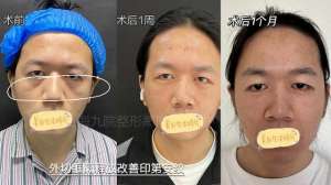 印第安纹(讲讲印第安纹的那些事儿)