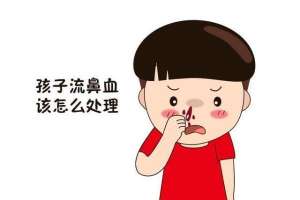 瞬间流鼻血教程(家长必看正确止鼻血的4个步骤 千万不要再头后仰、塞纸巾)