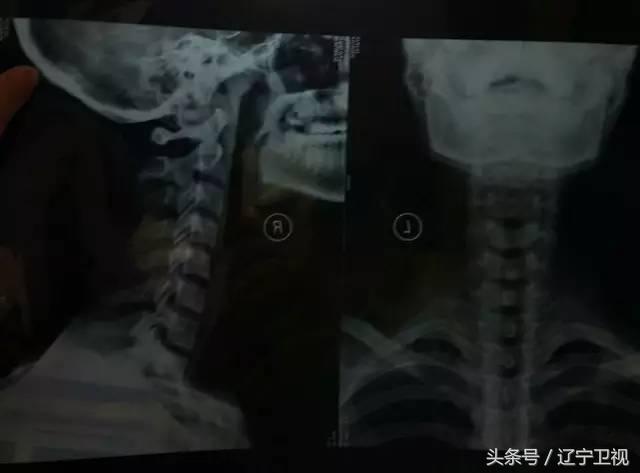 这才是真正的“蛇精病”，不服来战！