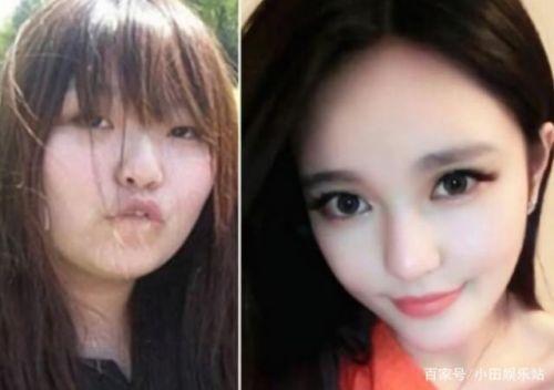 周扬青曝整容原因是什么？周扬青为什么要整容原来长啥样照片曝光
