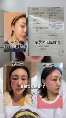 徐大宝(网红徐大宝称遭家暴否认出轨：有过相处11年男友，丈夫知情)