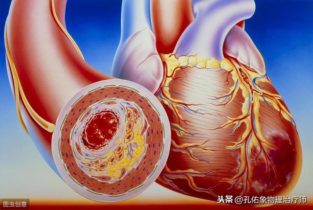 前胸贴后背的疼痛，不一定是心绞痛，建议收藏