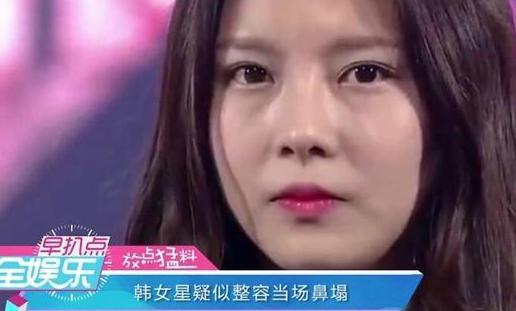 正常鼻子吸到断气都不可能达到的效果，快来看看任娜英的整容鼻子